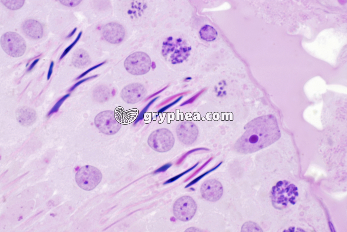 Testicule Rat CT x400 - gryphea.com